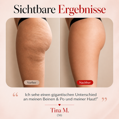 SoaSculpt™ Rotlicht-Beinband