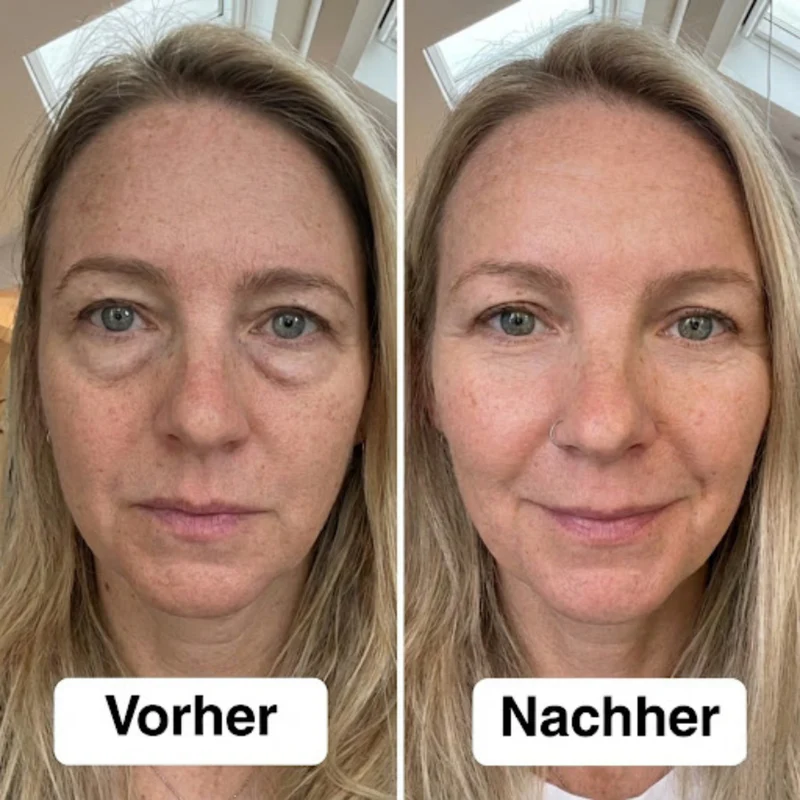 SoaSculpt™ Rotlicht-Augenpads