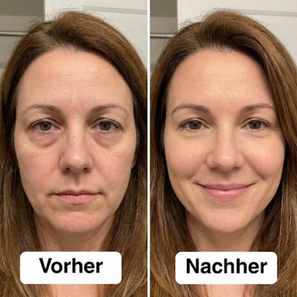 SoaSculpt™ Rotlicht-Augenpads