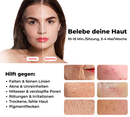 SoaSculpt™ Rotlicht-Gesichtsmaske