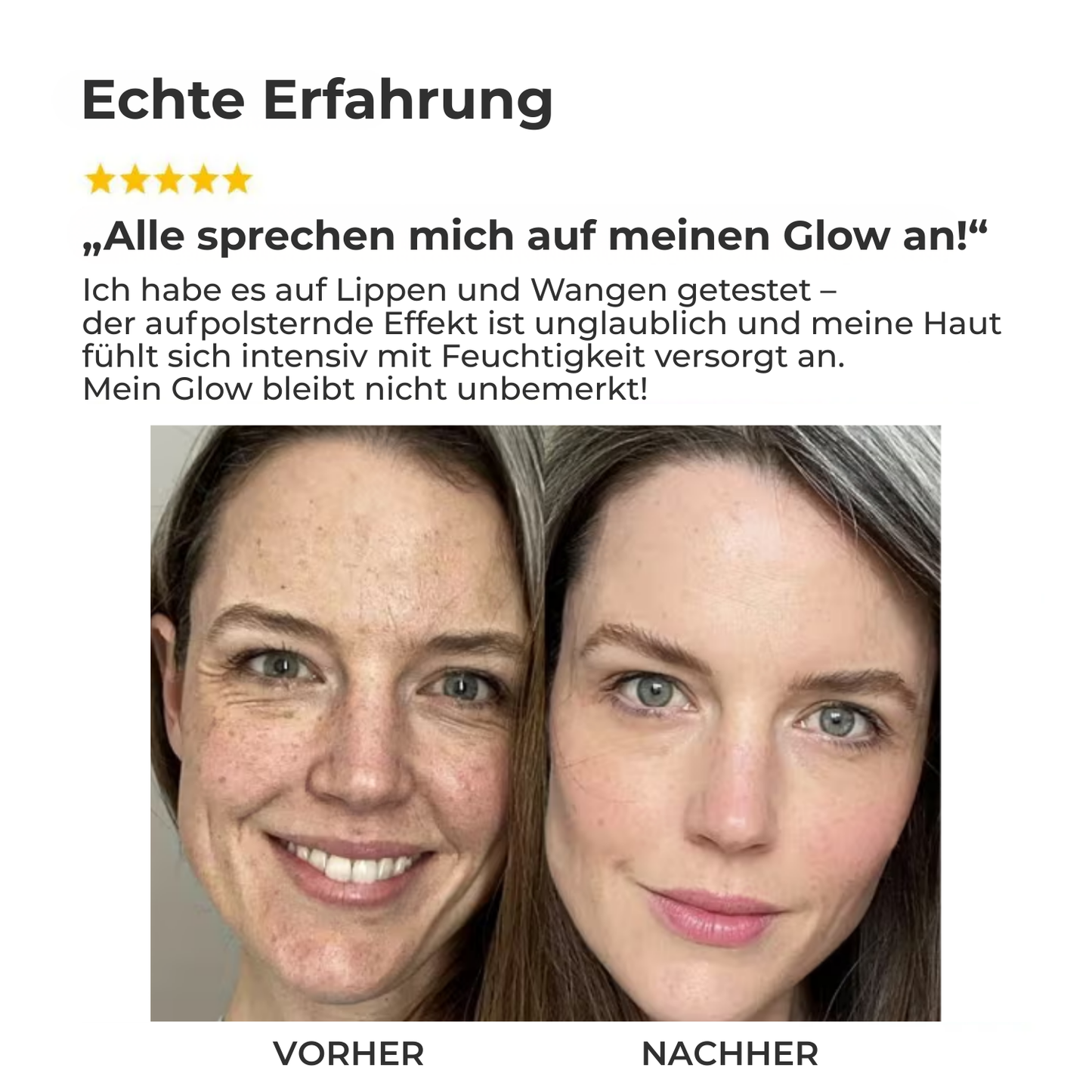 SoaSculpt™ Kollagen-Lifting-Serum